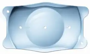 Implant EVO Lens Toris